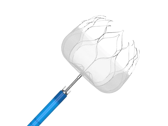 MemoLefort Left Atrial Appendage Device